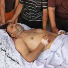 رفح: 4 شهداء و43 جريح بينهم 4 خطيرة