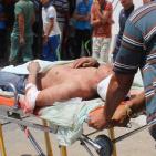 رفح: 4 شهداء و43 جريح بينهم 4 خطيرة