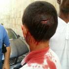 جرحى  مقدسيون في مواجهات  مع المحتلين في الاقصى اليوم 15/9/2015