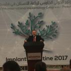 إنطلاق المؤتمر الدولي الخامس في زراعة الأسنان في رام الله