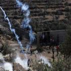 بالصور: 13 إصابة بالرصاص خلال مواجهات مع الاحتلال في بيتا