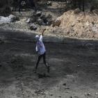 بالصور: 13 إصابة بالرصاص خلال مواجهات مع الاحتلال في بيتا