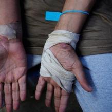 خاص | تقارير جديدة توثق تعرض الأسرى للتعذيب وحراك عالمي لإنقاذهم