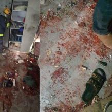 5 شهداء ومصابون وأضرار جراء سقوط 198 شظية صاروخية بالضفة خلال 3 أيام