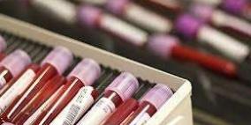 تنظيم حملة لفحص "فقر الدم" في قرى جنين