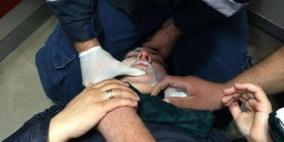 اصابة سيدة واعتقال شاب في مواجهات  بالقدس المحتلة