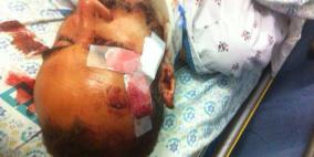 مستوطنون يعتدون على مواطن في القدس