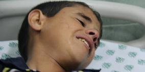 محدث3 :حصيلة العدوان على غزة: 83 شهيد وأكثر من 550 جريح