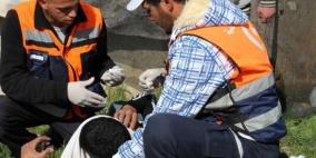 اصابة شاب بجروح خطيرة خلال اعتداء الاحتلال على مسيرة كفر قدوم