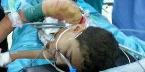 (محدث2)..(صور) قذائف الاحتلال تصيب 7 مواطنين شرق خانيونس