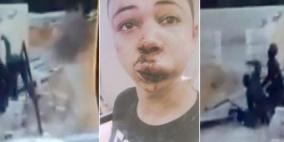 مطالبة بمحاكمة جنديين اسرائيليين لتعذيبهم طارق ابو خضير