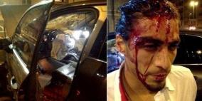 "قدم" أوروبا.. أسبوع الدماء والخيانة وتكسير "المراحيض"