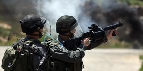 اصابة متضامن ايطالي برصاص اسرائيلي في كفر قدوم