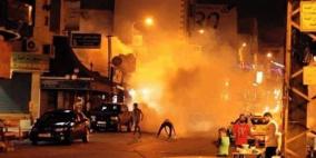 7 اصابات بينهم صحفي في مواجهات قلقيلية