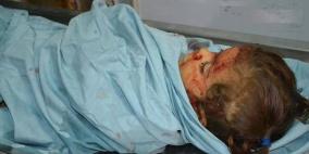 غزة: جولة من العدوان تخلف شهيدة و6 اصابات