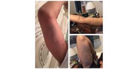 صورة سيلفي تكشف تورط لاعب أميركي بجريمة اعتداء