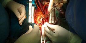 مركز جراحة القلب بالمستشفى الأوروبي يجري عملية نوعية