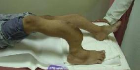 مناشدة عاجلة جدا للسيد الرئيس محمود عباس ولأهل الخير