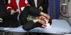 570 شهيد و3350 مصاب حصيلة العدوان المتواصل على y.m