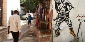 شباب على عكاز.. ضحايا سياسة تحطيم العظام في الضفة