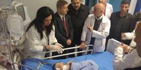 تحسن ملحوظ على حالة "الطفلة الرضيعة"