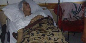 فتى جريح لم يذق طعم النوم منذ 17 يوماً بسبب الألم