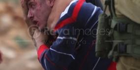 'الهلال الاحمر': 158 إصابة في المواجهات المندلعة منذ الصباح بأرجاء الضفة