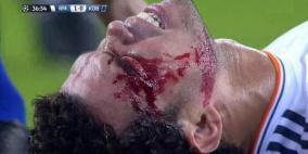 بيبي "الفدائي" يغرق في دمائه.. ويرفض ترك الملعب