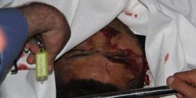 وفاة شاب في انفجار داخلي شمال غزة