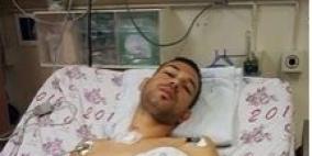 بعد أن اطلق النار عليه بـ"الخطأ" .. الاحتلال يخلي سبيل الجريح حجازي