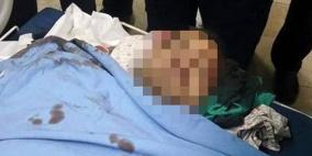 الأسير الشلالدة محتجز في مستشفى 'شعاري تسيدك' ولا يعلم بنبأ إعدام ابن عمه