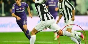 سجّل مرتدياً "الجوارب" .. واحتفل بحمل الحذاء