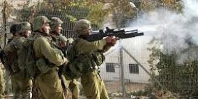 إصابات في مواجهات مع الاحتلال شرق طوباس