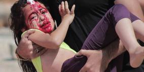 اصابة طفلة في كفرقدوم