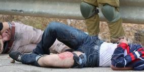 رصاصة في الركبة تقتل حلما !