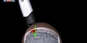 ماسحات ضوئية جديدة.. لإنقاذ أرواح الملاكمين