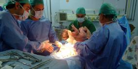 دراسة تكشف الآثار طويلة المدى للولادة القيصرية