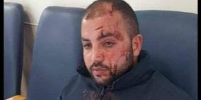 إصابة سائق حافلة مقدسي بجروح جراء اعتداء جديد للمستوطنين