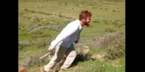 إصابة راعي أغنام بجروح متوسطة بهجوم مستوطنين جنوب الخليل 