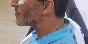 صور- الاحتلال يعتدي على مقدسي بوحشية وهو مقيد