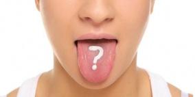 لون لسانك .. مرآة صحتك