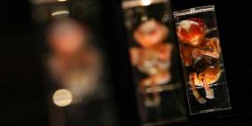 وفاة طبيب تكشف "مأساة بشعة" داخل منزله