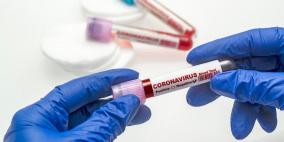 الصحة العالمية: 20 لقاحا مرشحا ضد كورونا