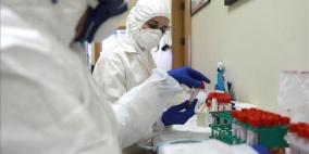 حالتي وفاة و602 إصابة جديدة بكورونا و825 حالة تعافٍ خلال 24 ساعة 