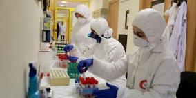 الصحة: 4 حالات وفاة و532 إصابة جديدة بكورونا و602حالة تعافٍ