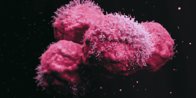 السرطان ليس معديا ويمكن أن يكون سببه فيروسيا