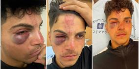 مستوطنون يعتدون بالضرب على فتى في البلدة القديمة من القدس