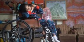 منظمة أمريكية تُحذّر: 6 آلاف مبتور في غزة يحتاجون إعادة تأهيل عاجل ودعم نفسي 