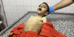 سلاح التجويع الإسرائيلي يقتل طفلا في غزة