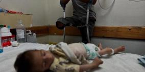 ارتفاع عدد شهداء التجويع في غزة إلى 122